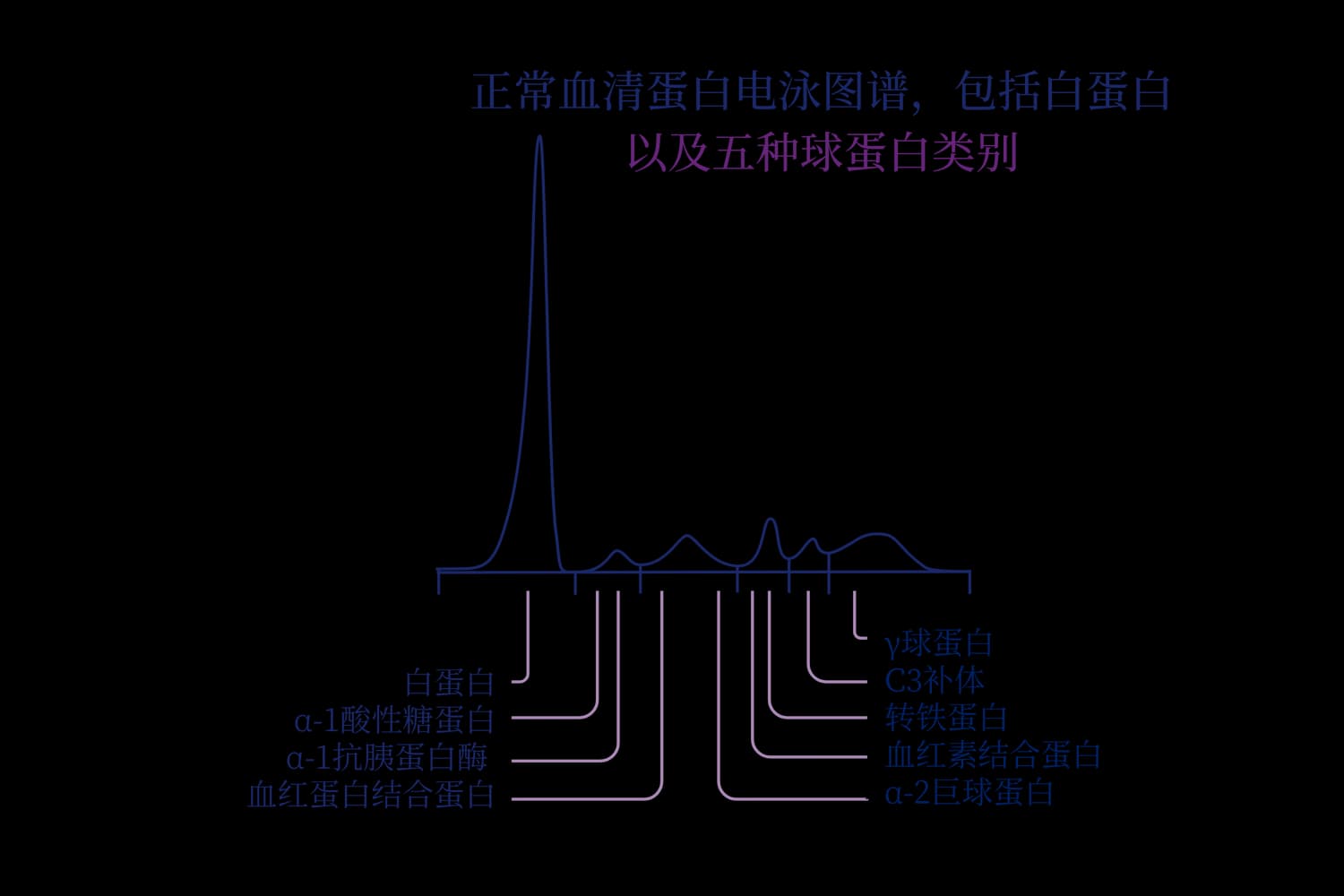 正常血清蛋白电泳图谱，包括白蛋白以及五种球蛋白类别